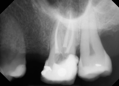 Digital X-rays